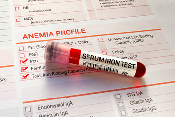 Blood sample for analysis of Serum Iron test in laboratory. Blood tube test with requisition form...