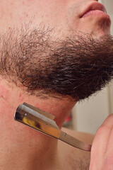 Man Shaving a dangerous razor close-up. Irritation after shaving. Sores from shaving on the neck....