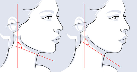 Woman face vector illustration. Correction of the shape of the face and chin. Jaw angle