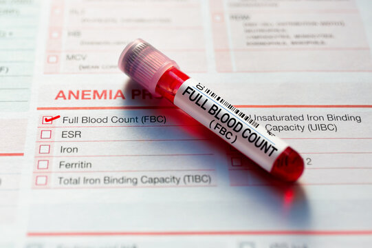 Blood sample for analysis of Full Blood Count FBC test in laboratory. Blood tube test with requisition form for Full Blood Count FBC CBC test