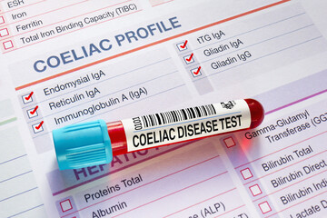 Blood sample tube for analysis of Coeliac and gluten disease test in laboratory. Blood tube test with requisition form for coeliac test. Blood sample tube for analysis of Coeliac and gluten disease