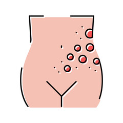 lichen shingles disease color icon vector illustration