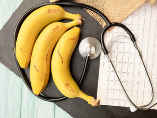 bananas healthy food to improve health, benefits for heart disease and vascular diseases,...