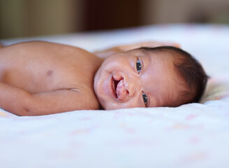 She wont let her birth defect get her down. Portrait of a baby girl with a cleft palate lying on a bed. - obrazy, fototapety, plakaty