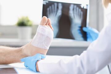 A doctor looks at an x-ray of a man's injured leg, blurry
