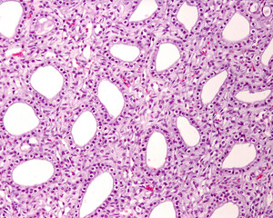 Kidney medulla. Papillary ducts