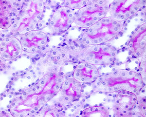 Kidney. Convoluted tubules. Periodic acid–Schiff (PAS) method