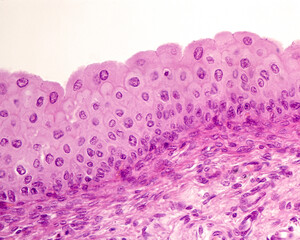 Urinary bladder. Epithelium
