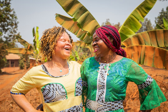 Two African friends look at each other and laugh, an albino girl with her black friend. African women, concept of friendship and difference in africa