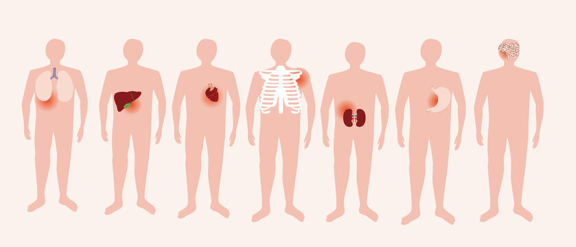 Pain in body, isolated people with human organs, Flat vector stock illustration, Diseases of lungs, liver, heart, stomach, brain