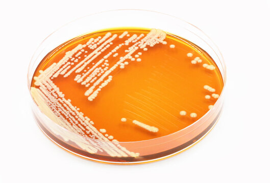 A Plate Of The Probiotic Yeast Saccharomyces Boulardii