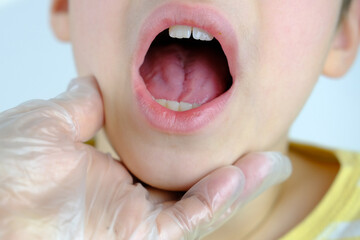 dentist, doctor examines oral cavity of small male patient, closeup teeth child, concept dentistry,...