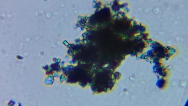 Microscopic bacterial germ microbe floating around organic tissue cells under microscope