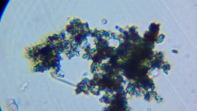 Microscopic bacterial germ organism floating around organic tissue cells under microscope