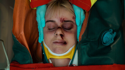 Close Up Shot of an Unconscious Young White Teenager Laying in a Stretcher With a Neck Brace, Face Covered in Blood Stains and Bruises. 