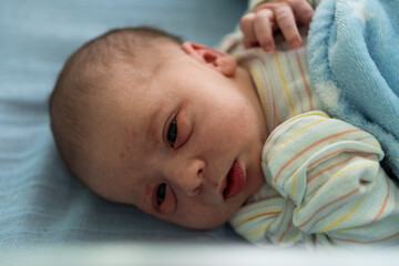 Awake Newborn Baby Face Portrait Acne Allergic Irritations Early Days Grimace Crying On Blue Background. Child Start Minutes Of Life. Infants, Childbirth, First Moments Of Borning, Beginning Concept.