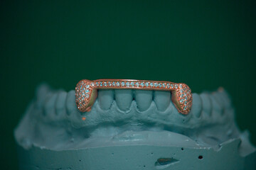Grillz - Dental Jewelry 