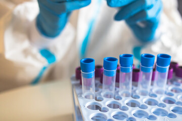 Process of coronavirus PCR antigen testing examination by nurse medic in laboratory lab, COVID-19...