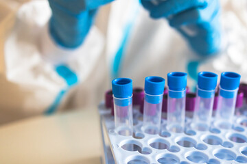 Process of coronavirus PCR antigen testing examination by nurse medic in laboratory lab, COVID-19 swab collection kit, test tube for taking OP NP patient specimen sample, patient receiving test