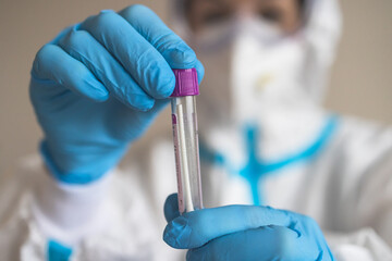 Process of coronavirus PCR antigen testing examination by nurse medic in laboratory lab, COVID-19 swab collection kit, test tube for taking OP NP patient specimen sample, patient receiving test