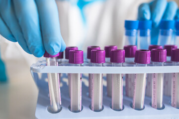 Process of coronavirus PCR antigen testing examination by nurse medic in laboratory lab, COVID-19 swab collection kit, test tube for taking OP NP patient specimen sample, patient receiving test © tsuguliev