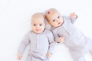 a little child with a hemangioma or a tumor on his head, two newborns, a twin baby, a girl in a...