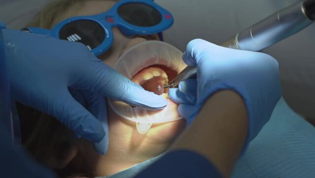 little girl with oral dilator at dentist's appointment. polishing of teeth