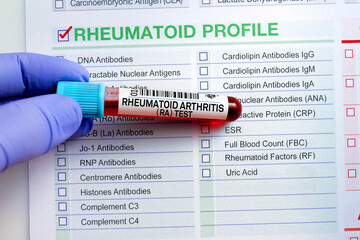 Blood tube test with requisition form for RA Rheumatoid Arthritis test. Blood sample tube for analysis of Rheumatoid Arthritis RA profile test in laboratory