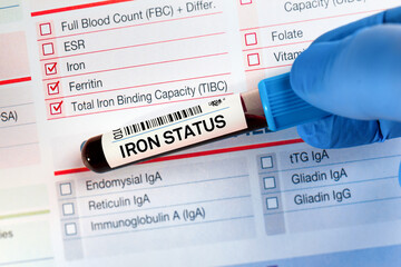 Blood tube test with requisition form for Iron status Test. Blood sample tube for analysis of Iron Status Tests. - obrazy, fototapety, plakaty