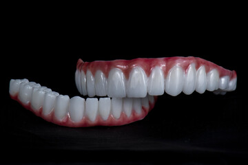 press ceramic crowns on implant bridges