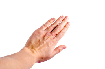 skin irritation on left wrist dermatitis