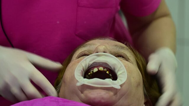 The dentist establishes the patient's coffers, dental procedure, modern dental treatment.