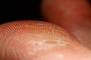 Fototapeta premium Macro texture of cracked foot