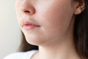 A close-up of a woman's face with a mustache over her upper lip. The concept of hair removal and...