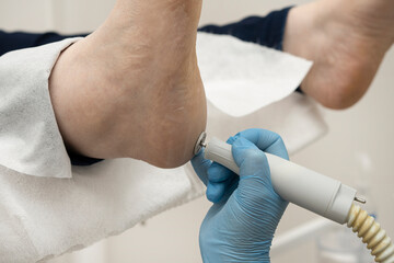 Callus peeling using professional pedicure drill machine. Spa foot treatment. Removing hard, callused skin for soft feet.