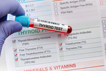 Blood sample tube for analysis of Thyroid tests in laboratory. Blood tube test with requisition form for Thyroid gland test