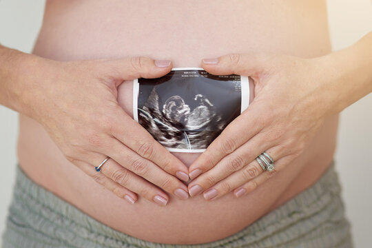 We cant wait to meet you. Shot of an unidentifiable pregnant woman holding a sonogram in front of her belly.
