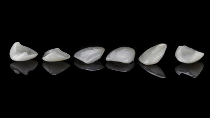 Excellent composition of ceramic veneers for upper jaws on black glass with creative reflection © Dental Pro Content