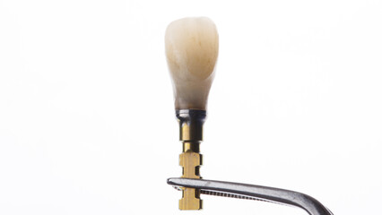 Dental crown of a central tooth with a transfer on a white background