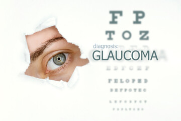 Glaucoma disease poster with eye test and blue eye on left. Isolated on white