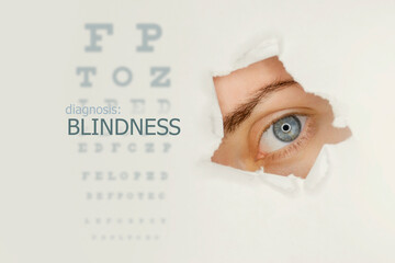 Blindness disease poster with eye test chart and blue eye on right.Studio grey background