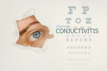 Conjuctivitis disease poster with eye test chart and blue eye on right. Studio grey background