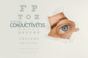 Conjuctivitis disease poster with eye test chart and blue eye on right. Studio grey background