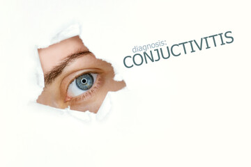 Conjuctivitis disease poster with blue eye on left.Isolated on white