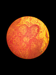 Obraz na płótnie Canvas Biological histological fixed stained specimen of a lymph node.
