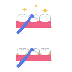 歯と歯間ブラシ