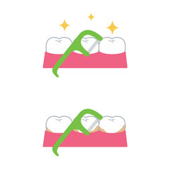 歯とデンタルフロス