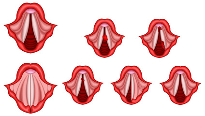 声帯　病気　構造