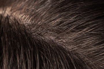 Super macro close up hair and scalp.