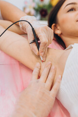Procedure removal of hair permanently in a woman's armpits using metod electro epilation. Permanent...
